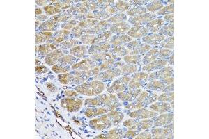 Immunohistochemistry of paraffin-embedded mouse stomach using VPS37A antibody.
