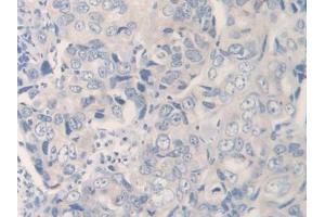 Used in DAB staining on fromalin fixed paraffin- embedded kidney tissue (IL12A 抗体  (AA 23-219))