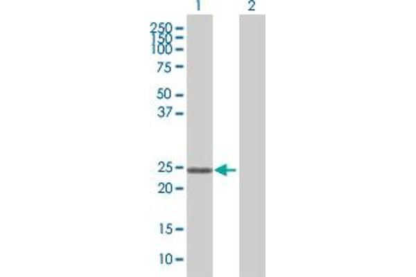 Zinc Finger Protein 22 抗体  (AA 1-224)