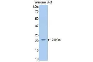 Western Blotting (WB) image for anti-Complement Factor P (CFP) (AA 54-217) antibody (ABIN3207870) (CFP 抗体  (AA 54-217))