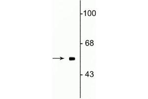 Western blot of rat testes lysate showing specific immunolabeling of the ~58 kDa Fto protein. (FTO 抗体  (N-Term))