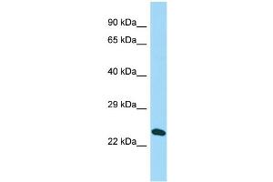 Host: Rabbit Target Name: C16orf53 Sample Type: Hela Whole cell lysates Antibody Dilution: 1. (PAGR1 抗体  (N-Term))