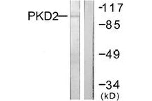 Western blot analysis of extracts from NIH-3T3 cells, treated with PMA 250ng/ml 15', using PKD2 (Ab-876) Antibody. (PKD2 抗体  (AA 829-878))