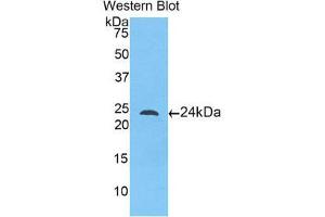 Western Blotting (WB) image for anti-Toll-Like Receptor 5 (TLR5) (AA 46-205) antibody (ABIN1175326) (TLR5 抗体  (AA 46-205))