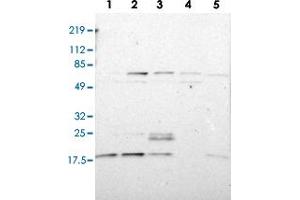 Western blot analysis of Lane 1: RT-4, Lane 2: U-251 MG, Lane 3: A-431, Lane 4: Liver, Lane 5: Tonsil with ATF3 polyclonal antibody  at 1:100-1:250 dilution. (ATF3 抗体)