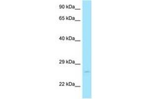 Image no. 1 for anti-RAB11A, Member RAS Oncogene Family (RAB11A) (C-Term) antibody (ABIN6748461) (RAB11A 抗体  (C-Term))