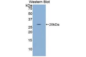 Western blot analysis of the recombinant protein. (WARS 抗体  (AA 140-347))