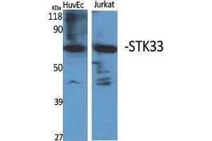 Western Blot (WB) analysis of specific cells using STK33 Polyclonal Antibody. (STK33 抗体  (N-Term))
