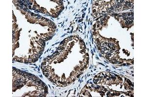 Immunohistochemistry (IHC) image for anti-Dicarbonyl/L-Xylulose Reductase (DCXR) antibody (ABIN1497785) (DCXR 抗体)