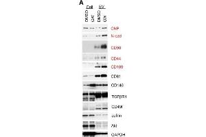 Western Blotting (WB) image for anti-Cofilin 1 (CFL1) antibody (ABIN2855302)