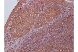 Immunohistochemistry (IHC) image for anti-Pyruvate Kinase M1/2 (PKM) (AA 2-531) antibody (ABIN7166916)