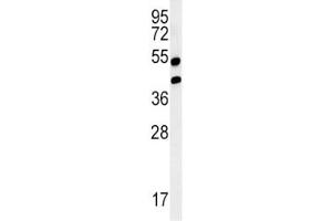 Western blot analysis of AGER / RAGE in mouse lung tissue lysate. (RAGE 抗体  (AA 29-59))