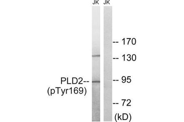 Phospholipase D2 Antikörper  (pTyr169)