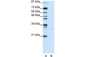 WB Suggested Anti-PDCD8 Antibody Titration:  0. (AIF 抗体  (C-Term))