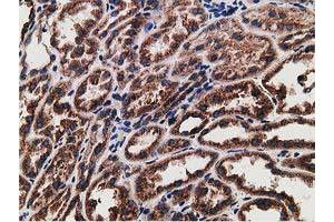 Immunohistochemical staining of paraffin-embedded Human Kidney tissue using anti-LMAN1 mouse monoclonal antibody. (LMAN1 抗体)