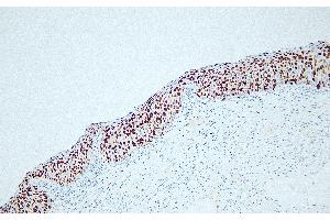 Immunohistochemistry (IHC) image for anti-Antigen Identified By Monoclonal Antibody Ki-67 (MKI67) antibody (ABIN7598906)