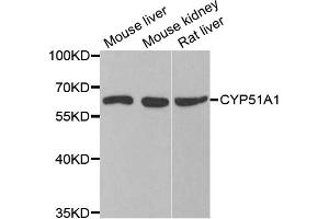 Western blot analysis of extracts of various cell lines, using CYP51A1 antibody. (CYP51A1 抗体)