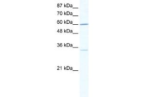 WB Suggested Anti-ZNF668 Antibody Titration:  0. (ZNF668 抗体  (N-Term))
