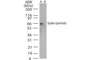 Image no. 1 for anti-SARS-Coronavirus Spike Protein (SARS-CoV S) (AA 288-303) antibody (ABIN199981) (SARS-CoV Spike 抗体  (AA 288-303))