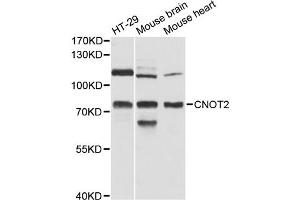 Western blot analysis of extracts of various cell lines, using CNOT2 antibody (ABIN6290147) at 1:3000 dilution. (CNOT2 抗体)