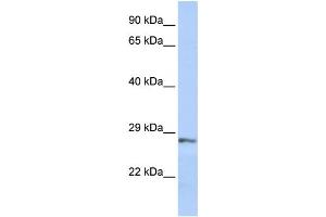 Western Blotting (WB) image for anti-Secreted Frizzled-Related Protein 2 (SFRP2) antibody (ABIN2459973) (SFRP2 抗体)