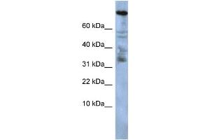WB Suggested Anti-ZNF251 Antibody Titration:  0. (ZNF251 抗体  (Middle Region))