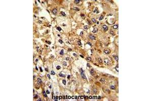 Immunohistochemistry (Paraffin-embedded Sections) (IHC (p)) image for anti-ATPase, Na+/K+ Transporting, beta 2 Polypeptide (ATP1B2) (AA 121-150), (Middle Region) antibody (ABIN950562)