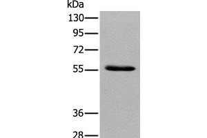 Western blot analysis of Human pancreas tissue using GPC4 Polyclonal Antibody at dilution of 1:500 (GPC4 抗体)
