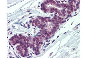 Anti-PCBP1 antibody IHC of human breast. (PCBP1 抗体  (AA 208-257))