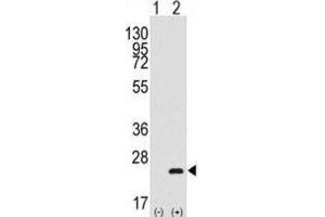 Western Blotting (WB) image for anti-BARX Homeobox 1 (BARX1) antibody (ABIN3003109) (BARX1 抗体)