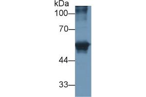 Detection of CEACAM1 in Human HepG2 cell lysate using Polyclonal Antibody to Carcinoembryonic Antigen Related Cell Adhesion Molecule 1 (CEACAM1) (CEACAM1 抗体)