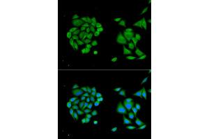 Immunofluorescence analysis of MCF-7 cells using DDX58 antibody. (DDX58 抗体)