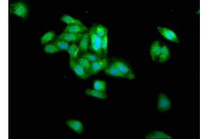 Immunofluorescence staining of HepG2 cells with ABIN7159237 at 1:266, counter-stained with DAPI. (PRAME 抗体  (AA 1-509))
