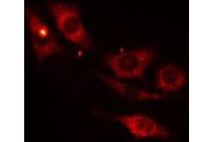 Immunofluorescence (fixed cells) (IF/ICC) image for anti-Myosin Binding Protein C, Slow Type (MYBPC1) (Internal Region) antibody (ABIN6257618)
