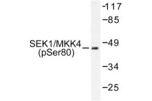 Image no. 1 for anti-Mitogen-Activated Protein Kinase Kinase 4 (MAP2K4) (pSer80) antibody (ABIN318113) (MAP2K4 抗体  (pSer80))