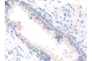 Immunohistochemistry (IHC) image for anti-Enoyl Coenzyme A Hydratase 1, Peroxisomal (ECH1) (AA 1-328) antibody (ABIN7443788)