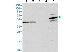 Western blot analysis of Lane 1: RT-4, Lane 2: U-251 MG, Lane 3: Human Plasma, Lane 4: Liver, Lane 5: Tonsil with PDE12 polyclonal antibody  at 1:250-1:500 dilution. (PDE12 抗体)