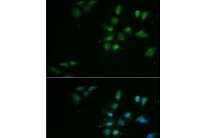 Immunofluorescence analysis of MCF7 cells using PPOX Polyclonal Antibody (PPOX 抗体)
