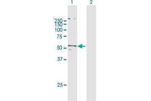 Western Blotting (WB) image for anti-Solute Carrier Family 2 (Facilitated Glucose/fructose Transporter), Member 5 (SLC2A5) (AA 1-501) antibody (ABIN948470)