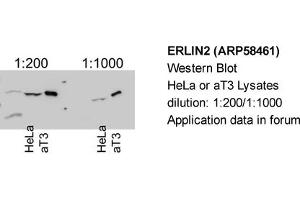 Western Blotting (WB) image for anti-ER Lipid Raft Associated 2 (ERLIN2) (Middle Region) antibody (ABIN406694) (ERLIN2 抗体  (Middle Region))