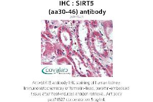 Image no. 1 for anti-Sirtuin 5 (SIRT5) (AA 30-46) antibody (ABIN1739285) (SIRT5 抗体  (AA 30-46))