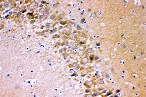 Immunohistochemistry (IHC) image for anti-Glutamate Receptor 1 (GLUR1) (AA 19-360) antibody (ABIN3043837)