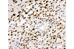 IHC-P: MPO antibody testing of human appendicitis tissue (Myeloperoxidase 抗体  (AA 406-745))