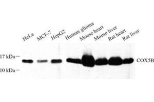 Western blot analysis of COX5B (ABIN7073665) at dilution of 1: 500 (COX5B 抗体)