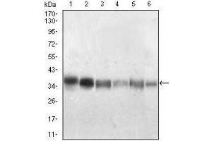Western Blotting (WB) image for anti-Protein Phosphatase 1, Catalytic Subunit, beta Isoform (PPP1CB) (AA 174-327) antibody (ABIN5542354)