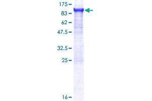 Image no. 1 for Cleavage and Polyadenylation Specific Factor 3, 73kDa (CPSF3) (AA 1-684) protein (GST tag) (ABIN1350233) (CPSF3 Protein (AA 1-684) (GST tag))