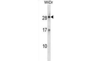 Western Blotting (WB) image for anti-Kallikrein-Related Peptidase 12 (KLK12) antibody (ABIN2998366) (Kallikrein 12 抗体)