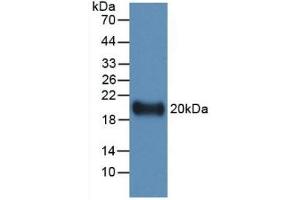 Detection of Recombinant IL19, Human using Monoclonal Antibody to Interleukin 19 (IL19) (IL-19 抗体  (AA 25-177))