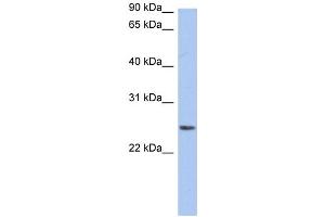 WB Suggested Anti-NRSN2 Antibody Titration:  0. (NRSN2 抗体  (Middle Region))