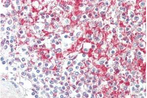 ABIN1781962 (5µg/ml) staining of paraffin embedded Human Spleen. (ADAM19 抗体  (Internal Region))